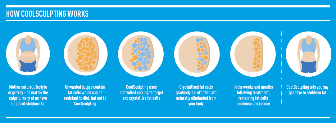 How Does Coolsculpting Work?