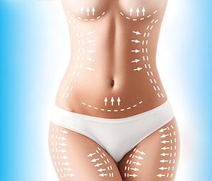  Liposuction Cosmetic Surgery Recovery and results