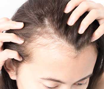 The science of hair transplantation