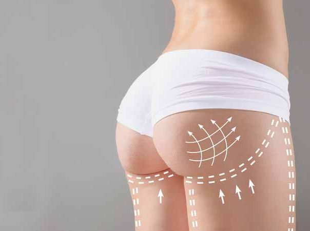 woman's buttocks with illustrations on it