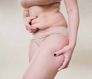 At CoolSprings Laser, Aesthetic & Skin Care Center in Franklin, TN, we use the tumescent liposuction technique, which facilitates safer, more effective treatment.