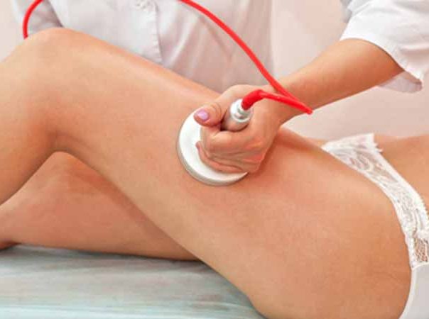 patient getting liposculpture on their legs