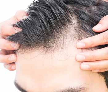 close up image of man's hair