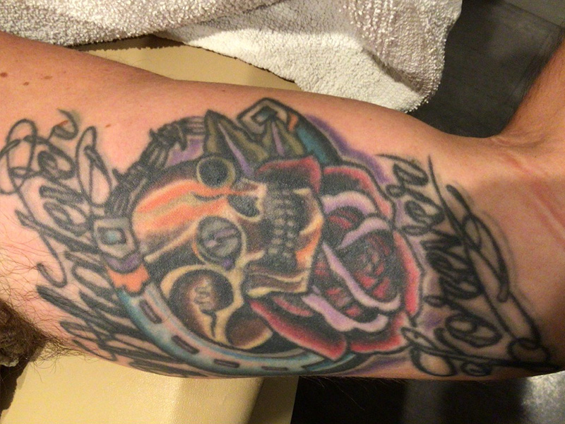 Laser Tattoo Removal Before and After | Jack + Jill Aesthetics