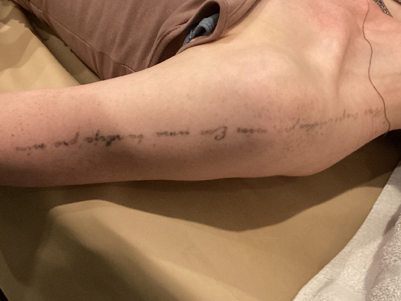 Laser Tattoo Removal Before and After | Jack + Jill Aesthetics