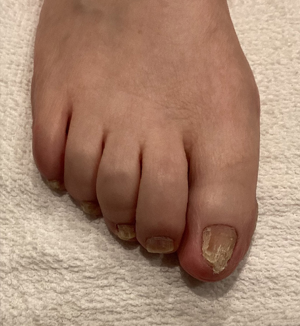 Skin Conditions Before and After | Jack + Jill Aesthetics