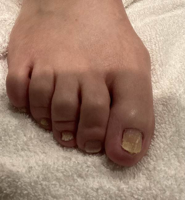 Skin Conditions Before and After | Jack + Jill Aesthetics