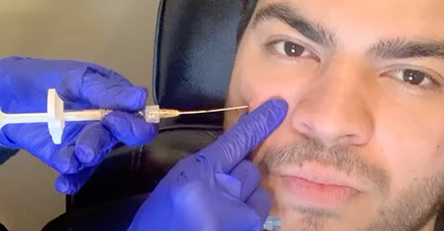 Treatment Video