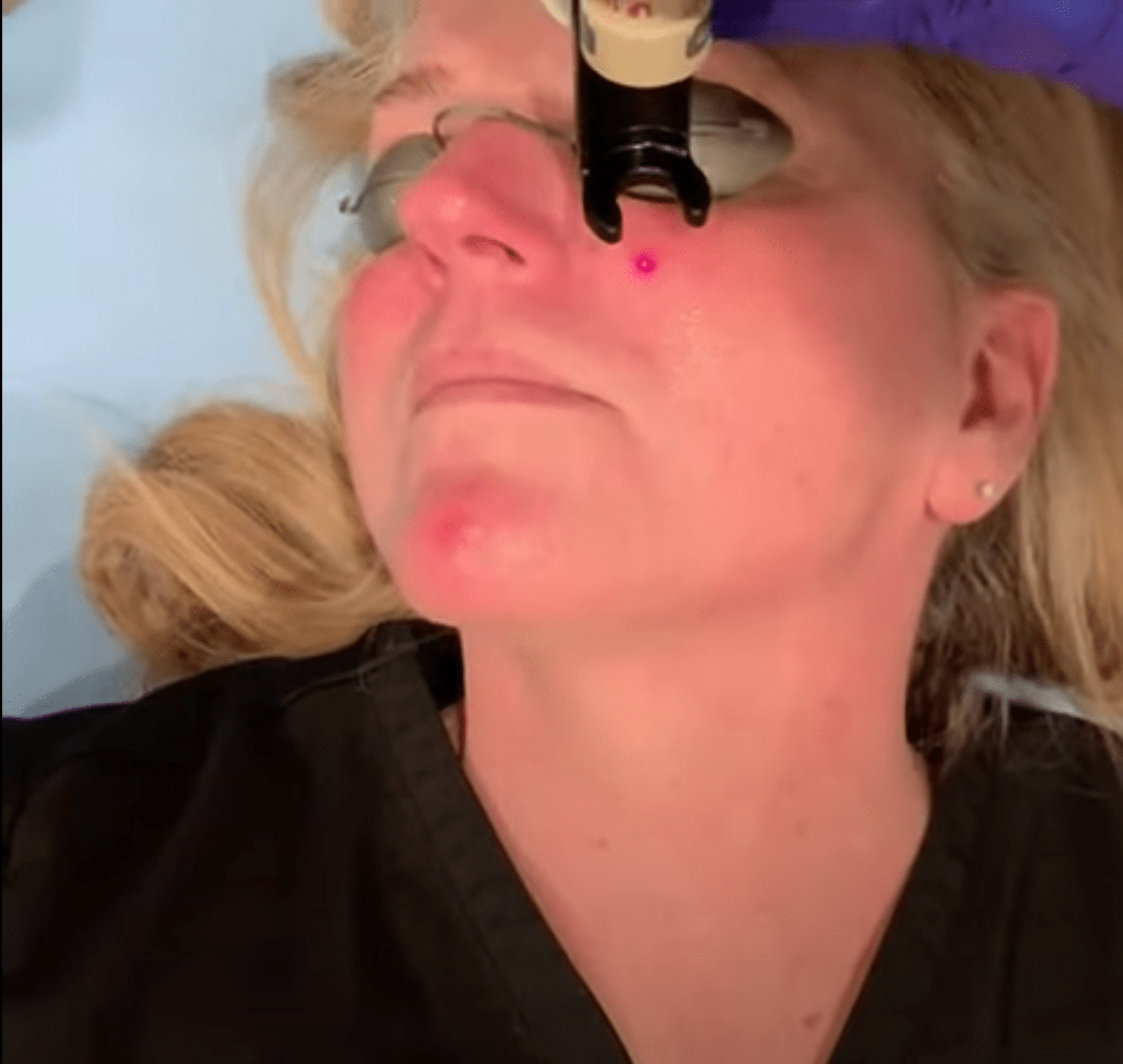 Treatment Video